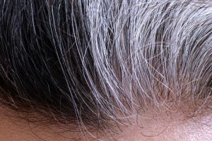 Manfaat Collagen bagi Tubuh, Tidak Hanya untuk Kulit